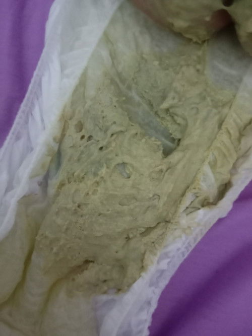 Pup baby 4 bulan warna pucat