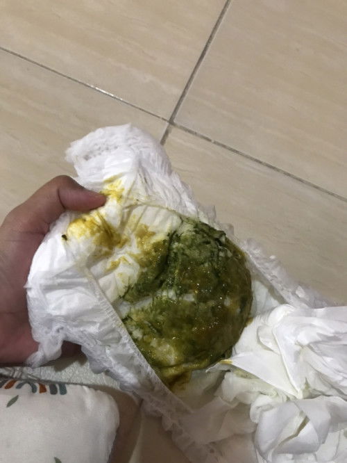 BAB Bayi berwarna hijau