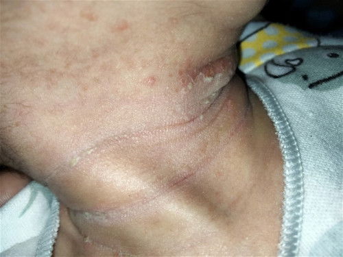 Serius nanya bun🙏