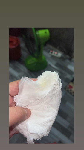 35 วีค มีมูกออกตามภาพ