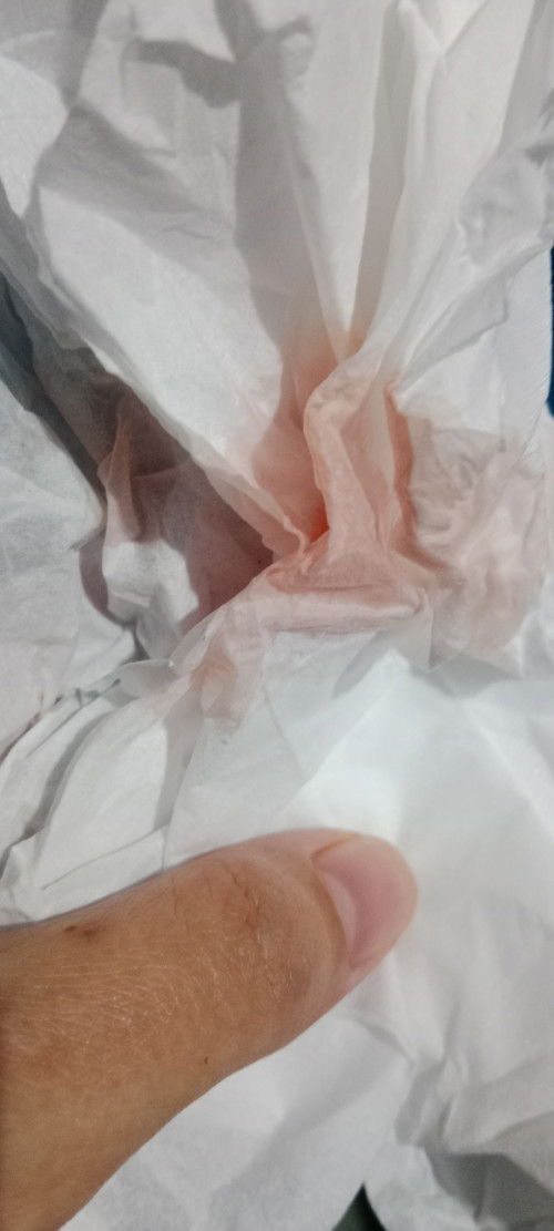 Flek tanda lahiran atau bukan?