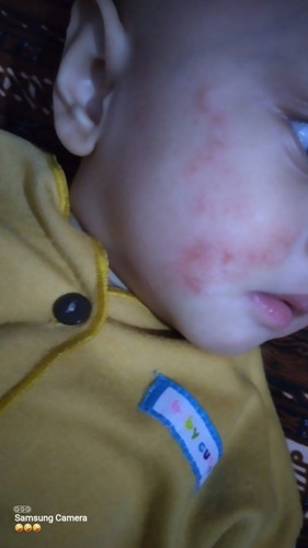 Spesialis anak atau kulit