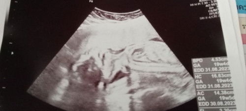 รบกวนแม่ๆดูให้หน่อยค่ะ