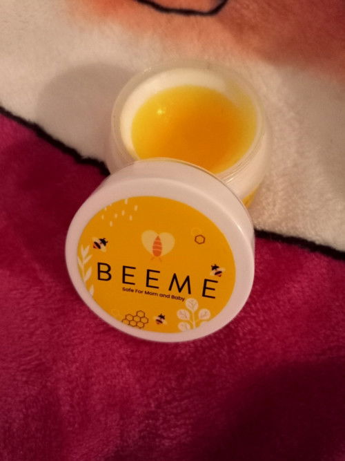 Pertolongan Pertama Untuk Permasalahan Kulit Bayi