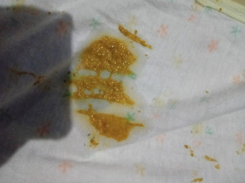 Usia 2 bln bab Kya gini ap trmsuk diare full asi ,udh 5× JM sgini ? Emng kmrin abis dirawat