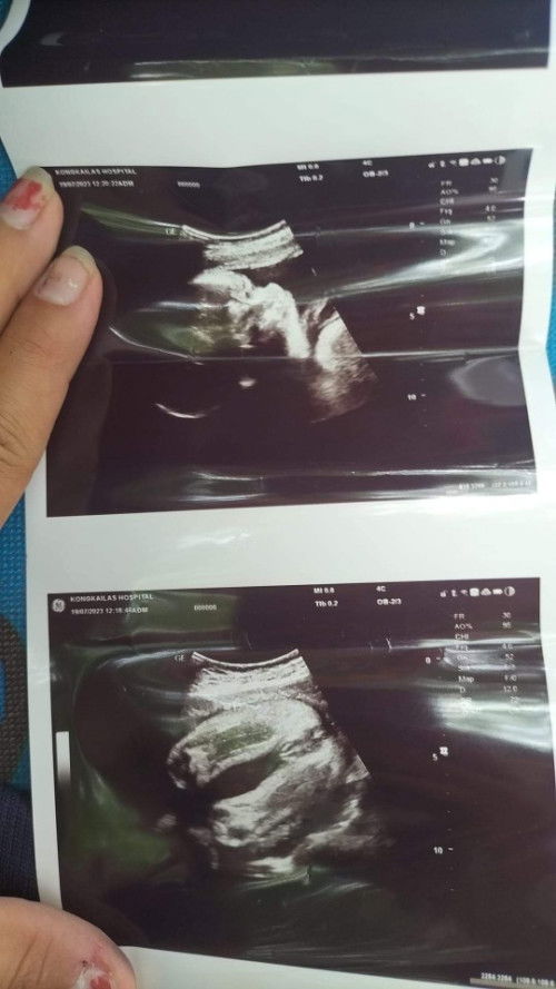 น้ำหนักลูก1234,gน้ำหนักดีไหมค่ะ อายุครรภ์29+3