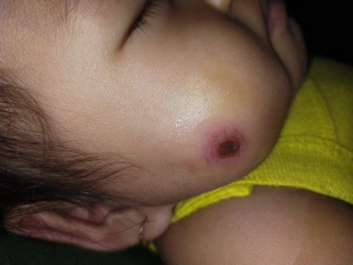 Suled en
#seriusnanya #bantusharing Bunda"ada yg baby nya luka gini ga??dikasih apa ya??awalnya itu