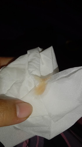 Maaf nih bund mau tanya saya hamil tua keluar lendir seperti ini tanda nya apa yah