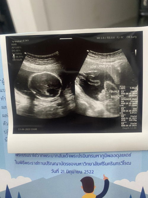 แม่ว่าหญิง หรือชาย ค่ะ