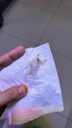 keluar stain coklat masa preggy 6-7 week