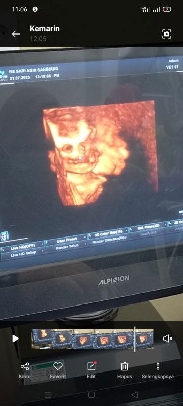 Gambar usia kandungan 23 Minggu masih belum jelas