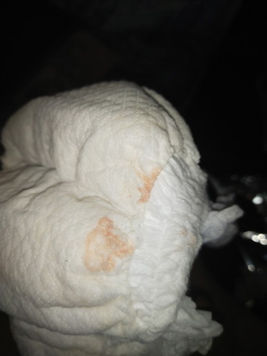 ลูกฉี่แบบนี้