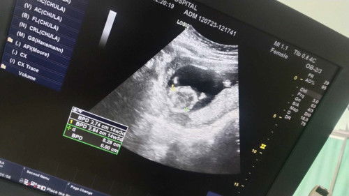 แม่เลี้ยงเดี่ยว