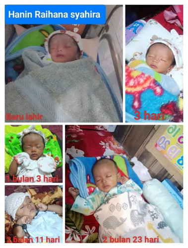 Perubahan warna kulit anak q Bun, ada yang pernah ngalamin gk, gmna skrng anak x bun