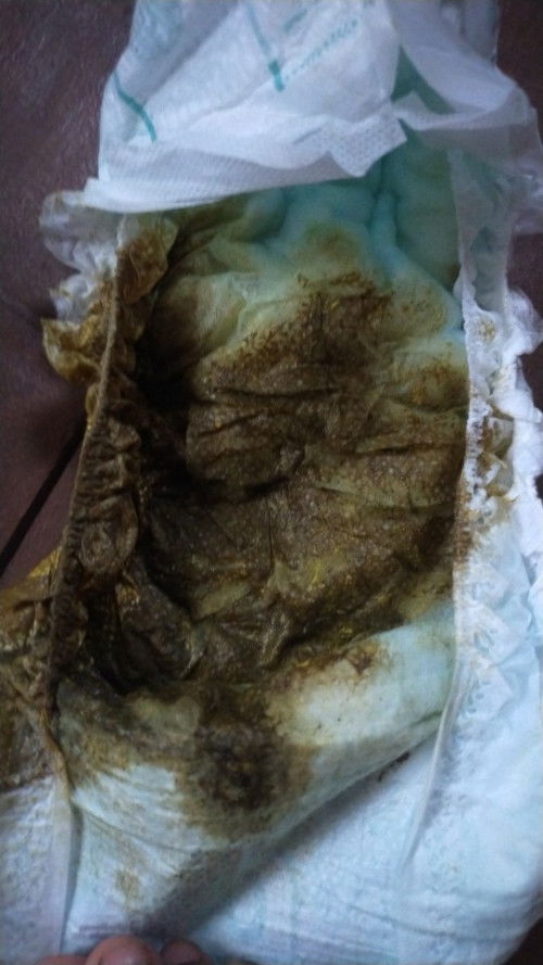 Ftm here po. 4 months old baby ko worried po ako sa poop ng baby ko kung normal paba ito o hindi na.