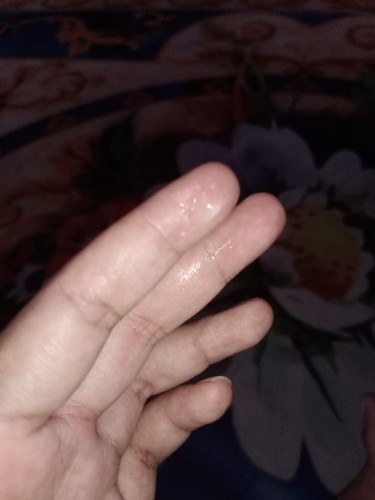 แบบนี้มูกรึตกขาวคะ 38+5