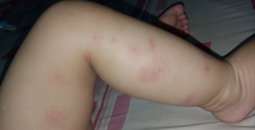 Kaki bayi merah
