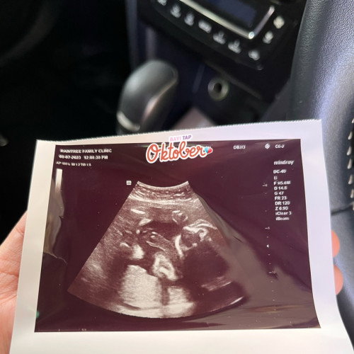 Gender baby