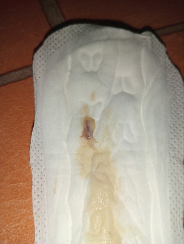 Discharge 35weeks pregnant