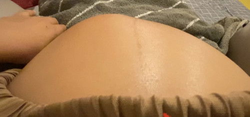 37+2 week แยกไม่ออกท้องปั้น หรือน้องโก่งตัว