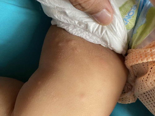 มีแม่บ้านไหนให้น้องกินปลาแซลมอนตอนอายุ 9 เดือนไหมค่ะ