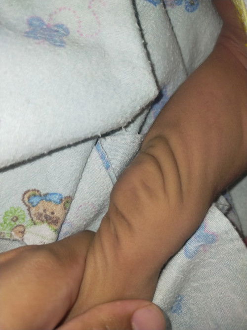 Kaki anaku kriput usia 1 bulan ..