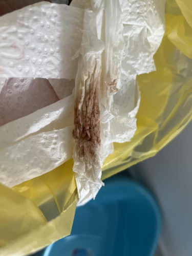 Saya 25minggu 3hari & ada bleeding darah pekat seakan akan warna coklat