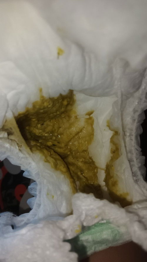 Bab bayi berlendir dan warna kuning kehijaun sdh berlangsung 3 harian