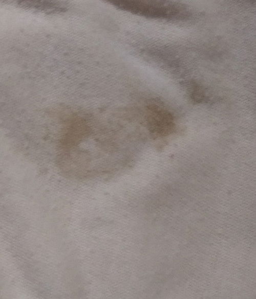 Flek coklat di 6 week