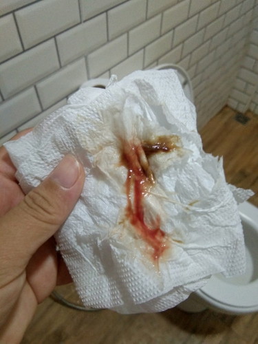 เตือนคลอด!!!