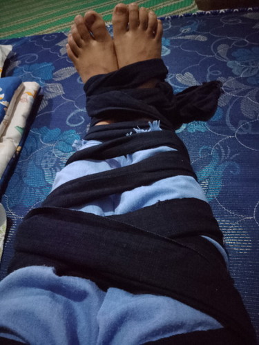 Lahiran normal ( pervaginam ) tanpa jahitan