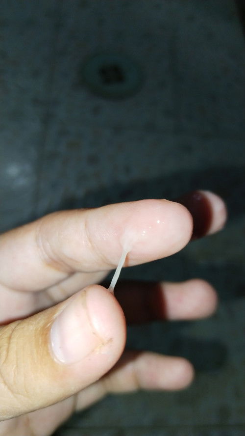 ควรไปหาหมอมั้ยคะ