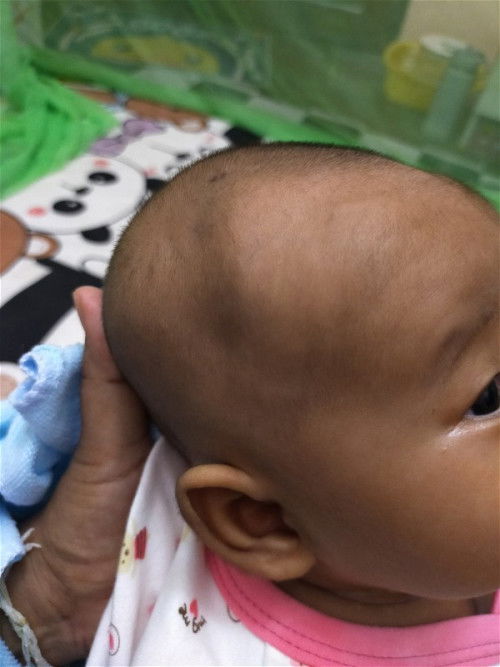 หัวแบบนี้ปกติมั้ยคะ