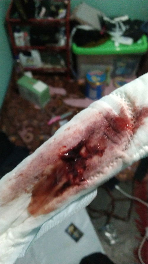 Hpl 27 juli pas di periksa dalam sama bidan smpe rmh keluar darah cmpur lendir darah sprti org haid