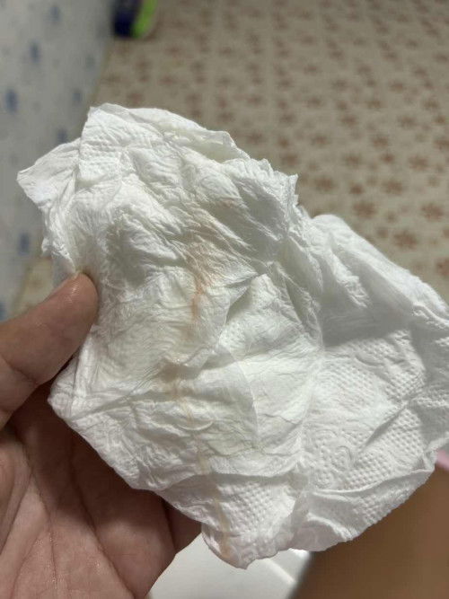 แบบนี้มูกปนเลือดไหมคะแม่ๆ39+3