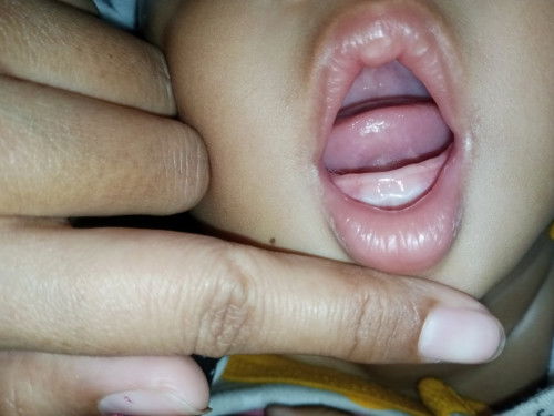 Tumbuh gigi atau bukan