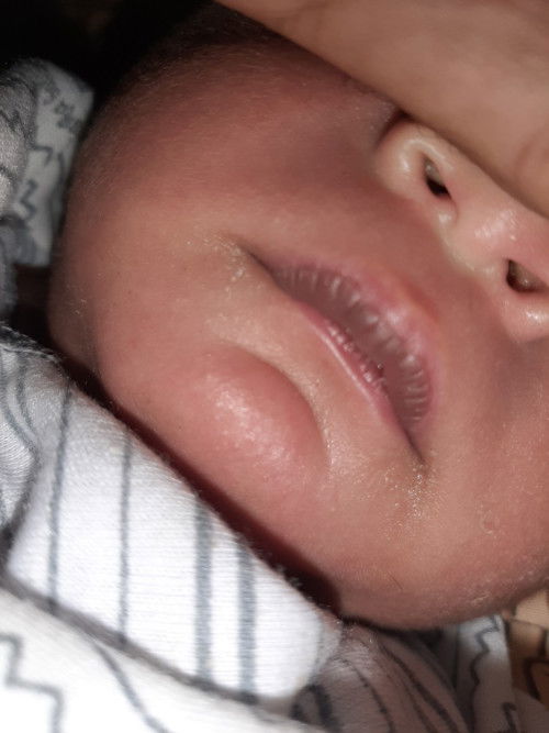 Bibir bayi menjadi gelap