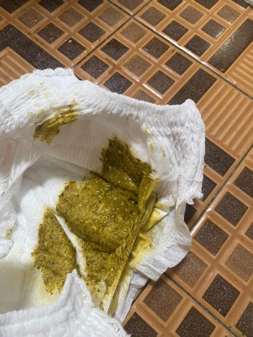 Sebelumnya bayiku asi cuma sekarang dibantu sufor