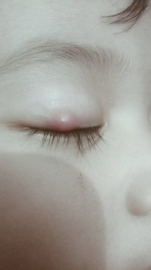 Bintitan atau apa ya ini