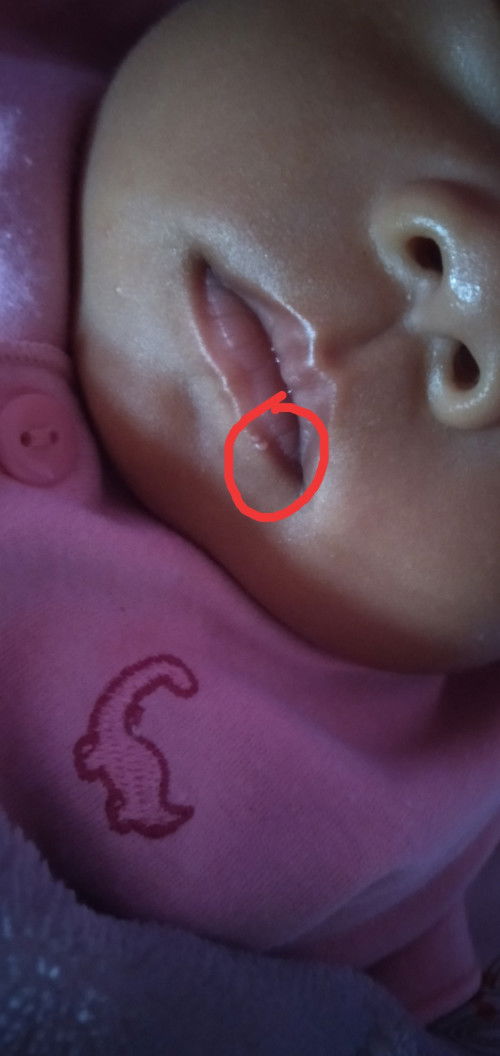 Bintik putih di bibir bawah