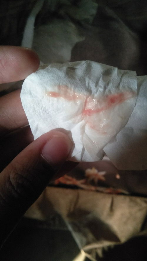 39weeks keluar lendir campur darah