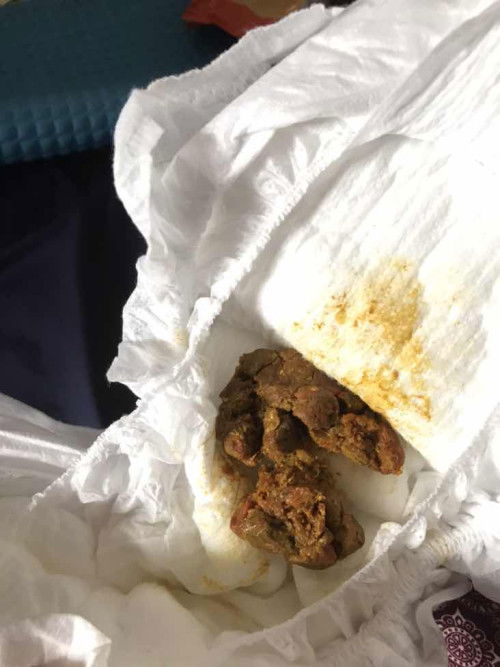 Najis baby lepas start solid food.