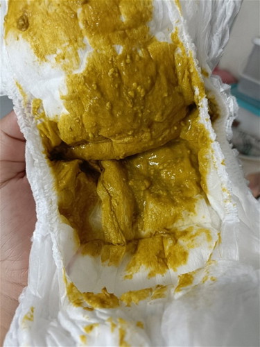 ถ่าบแบบนี้ปกติมั้ยคะ