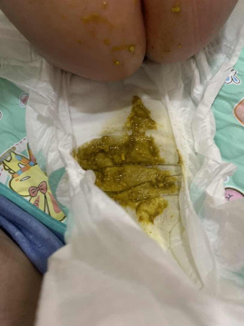 Poop ng baby ko
