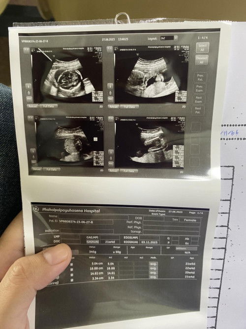 ขอสอบถามหน่อยค่ะ