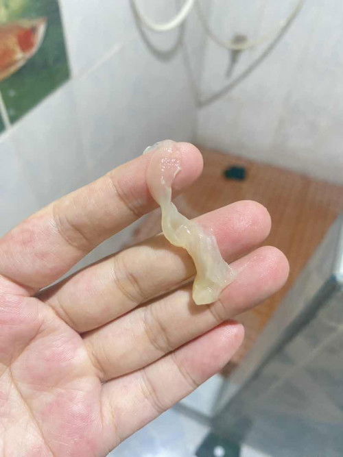 ตั้งครรภ์ 26 สัปดาห์ ตกขาวแบบในรูปอันตรายมั้ย