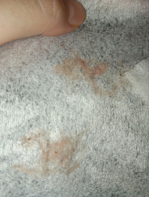 2 bulan setelah melahirkan keluar lendir dan flek