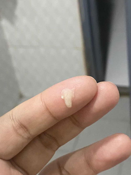 Mucus plug po ba ito? Please answer. 39 weeks preggy.