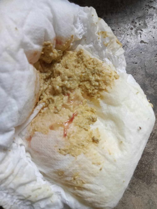 ถ่ายยืดตัว+ก้นแดง