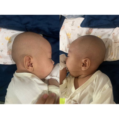 ลูกสาวหัวแบนข้างเดียว